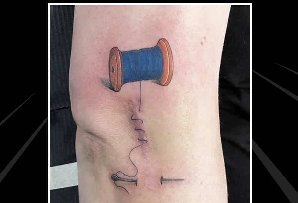 Dein Narben Cover Up Tattoo Spezialist